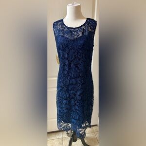 Chic Midnight Blue Lace Dress